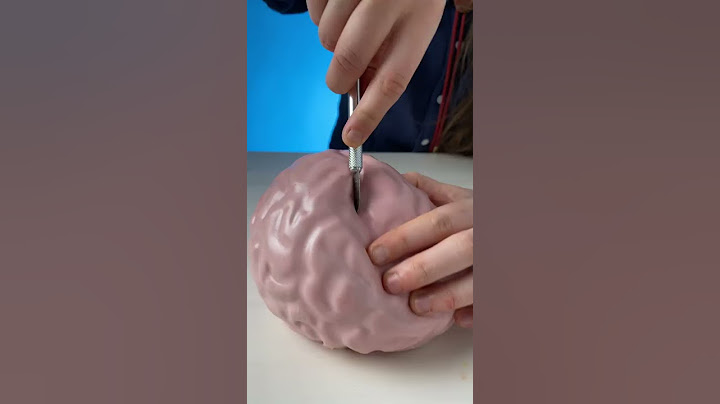 What's inside this Giant Brain Stressball? #shorts
