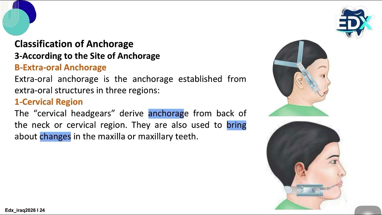 Anchorage in Orthodontic شرح محاضرة بعنوان