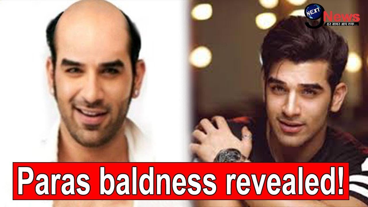 Bigg Boss 13 contestant Paras Chhabras without wig video goes viral   IWMBuzz