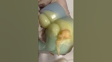 Mochi Pimple Popping #pimplepopping #satisfying #visualasmr #relax #cats #oddlysatisfying