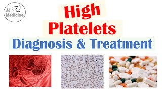 What is Thrombocytosis? Diagnosis \& Treatment of High Platelets | Rapid Review