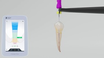 X-Smart Pro+: Getting-Started - Apex Locator Only Mode