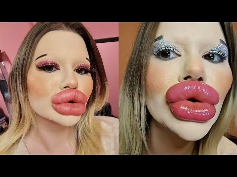 Andrea Ivanova aims to get the world's biggest cheeks after setting world's biggest lips record