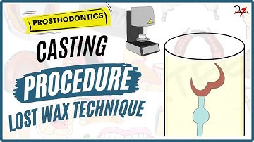 Casting Procedure in Dentistry | Lost Wax Technique