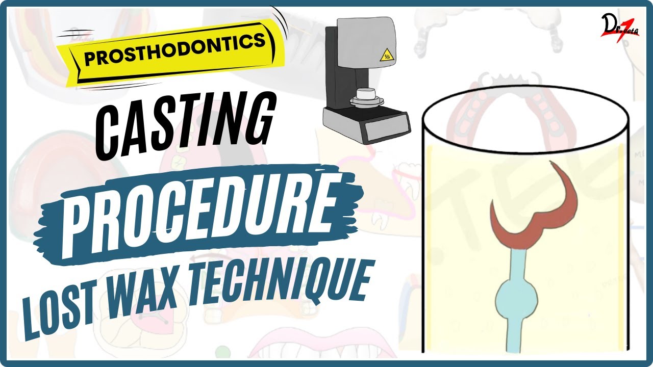 Casting Procedure in Dentistry | Lost Wax Technique