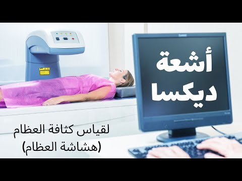 فيديو: ماذا يعني قياس العظم طبيا؟