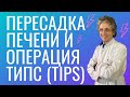 Трансплантация печени при циррозе и операция ТИПС (TIPS)