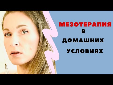 Щипковый массаж лица🔥🔥/МЕЗОТЕРАПИЯ 💉на ДОМУ/ЭФФЕКТИВНАЯ ТЕХНИКА САМОМАССАЖА ЛИЦА