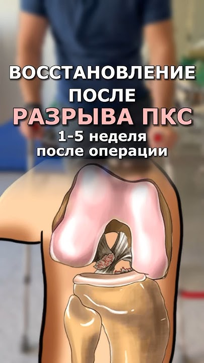 Восстановление связки плеча. Хирургия-артроскопия плечевого сустава в Москве - операция и цены Анатомия плечевого сустава, классификация повреждений и заболеваний. Плечовий суглоб анатомія, будова, м'язи і зв'язки плеча