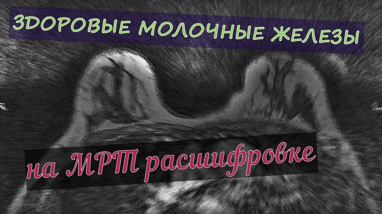 Как выглядит ЗДОРОВАЯ ГРУДЬ на МРТ молочных желез с расшифровкой снимков с диска