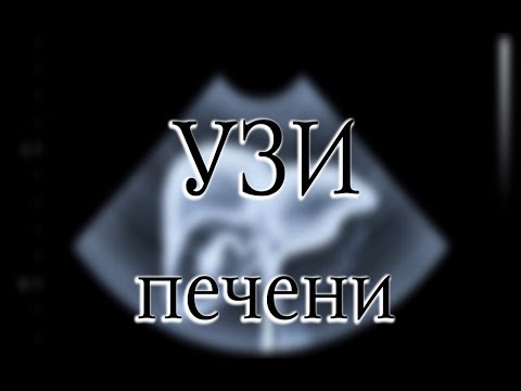 Узи печени: подготовка, нормы