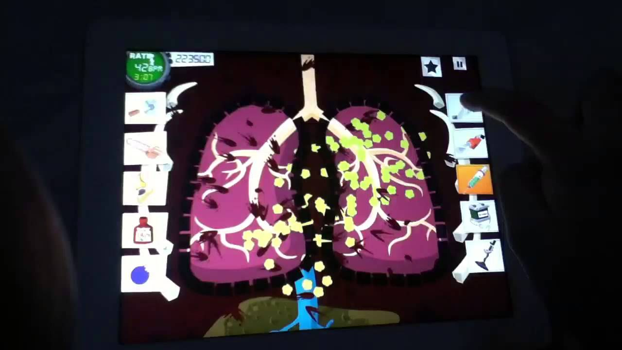 Amateur Surgeon 2 (iPad) : Tricks (Circus)