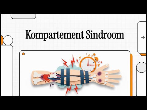 105 Kompartementsindroom - Oorsake, Simptome en Behandeling