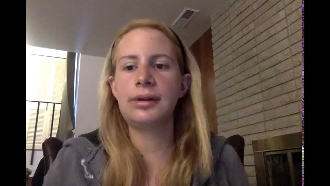 4 Days After Double Jaw Surgery for Class II Overbite YouTube