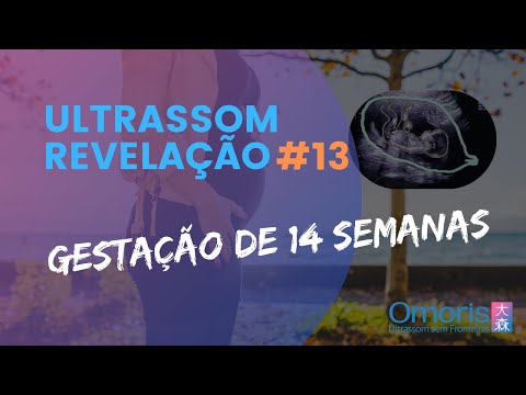 ULTRASSOM REVELAÇÃO #13 - Menino ou menina? Dá pra saber com certeza o sexo pelo tubérculo genital?