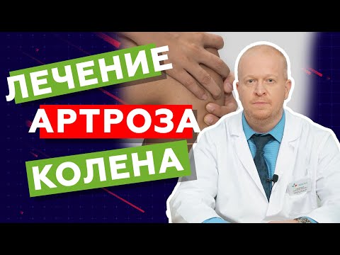 Лечение артроза колена. Артроз коленного сустава // zdravclinic.ru