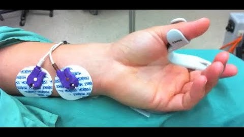 Monitoring neuromuscular function