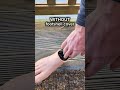Amputee without a Pro Armour footshell cover for prosthetic leg