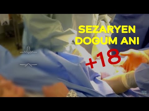 Sezeryan Doğum Videosu (Canlı)