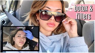 GETTING BOTOX AND FILLERS | the reason why i get them