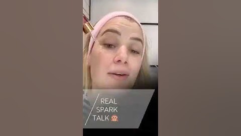 @me.my.chins.and.i is getting real about Spark™ Clear Aligners! 🫢
