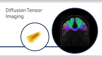inCCsight: A software for exploration and visualization of DT-MRI data of the Corpus Callosum