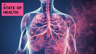 Amivantamab: A New Hope for Lung Cancer Patients