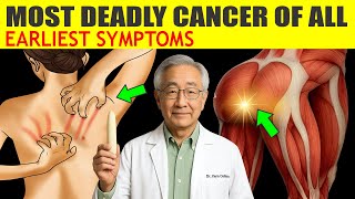 CÂNCER DE PÂNCREO: 8 sintomas iniciais que você nunca deve ignorar