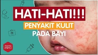 INI DIA 5 PENYAKIT KULIT PADA BAYI DAN SOLUSINYA