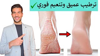 تخلص نهائيا من تشققات وجفاف كعب القدم | ترطيب - تنعيم وتفتيح فوري للقدم والكوع 👌