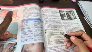 Surgery srb abdominal tb