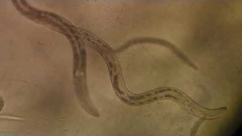 Part II: Microhydrodynamics of Living Suspensions in a Viscoelastic Fluid