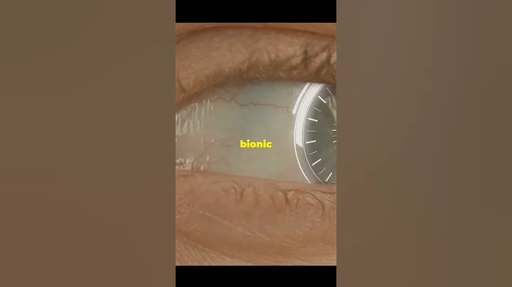 Human with a Bionic Eye! Is This the Future of Vision? 👁️🚀