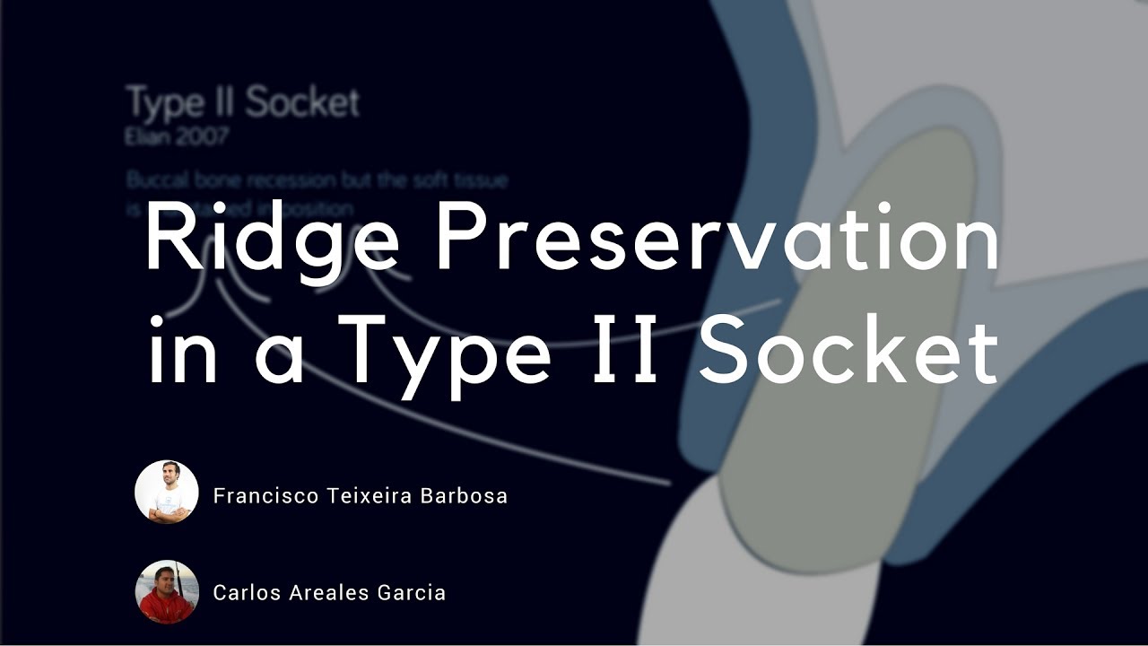 Socket Preservation In a Type II Socket Elian Classification YouTube