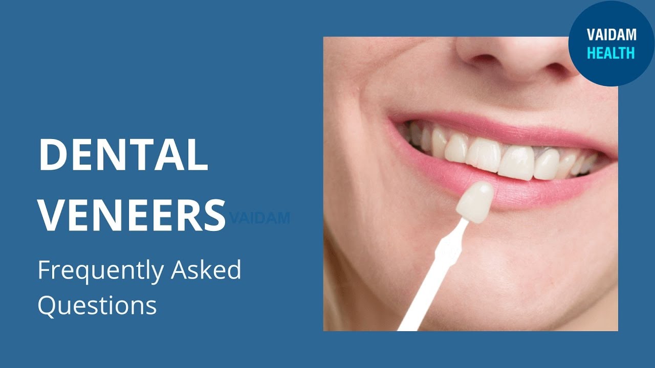 Dental Veneers- Frequently Asked Questions