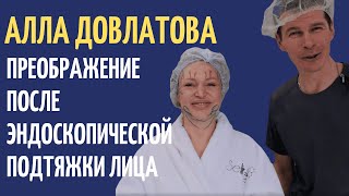 Алла Довлатова: Эндоскопическая расширенная подтяжка верхней зоны лица