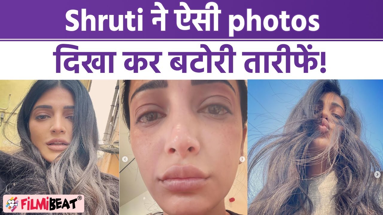 Shruti Haasan ने सूजी आंख और No Makeup वाला look दिखाया, Fans कर रहे जमकर तारीफ! FilmiBeat