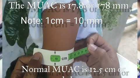 IMCI: Measuring Mid Upper Arm Circumference (MUAC)