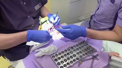 Voorbeeldvideo: Fourhanded werken