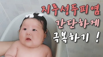 아기 지루성두피염 !! 쉽게 해결하는 방법?