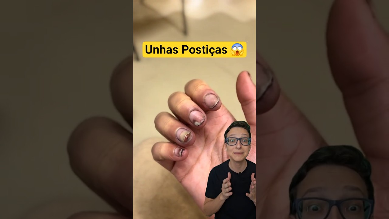 Unhas Postiças 😱#medicina #medico #enfermagem #enfermeira #manicure #pedicure Alerta Cola em Gel UV