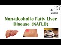 Non-Alcoholic Fatty Liver Disease, Risk Factors, Symptoms (ex. Fatigue), Treatment (ex. Coffee)