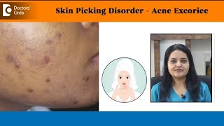 Can't Stop Picking My Skin !|Skin Picking Disorder|Acne Excoriee-Dr.Urmila Nischal | Doctors' Circle