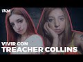 ¿Cómo es vivir con el síndrome Treacher Collins?  | #EnPrimeraPersona