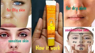 Vicco turmeric cream / (Honest Review in Hindi )/