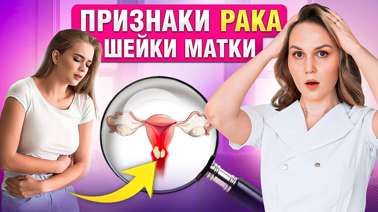 Неочевидные признаки РАКА шейки матки. Как не упустить!