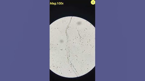 Thumbnail of Condom Under Microscope | TULO - Microscope #shorts #underthemicroscope #condom
