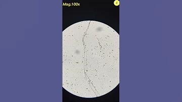 Condom Under Microscope TULO Microscope Shorts Underthemicroscope Condom 