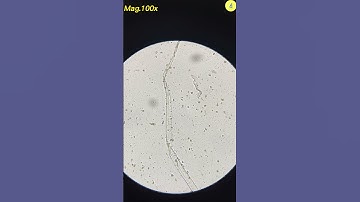 Condom Under Microscope | TULO - Microscope #shorts #underthemicroscope #condom