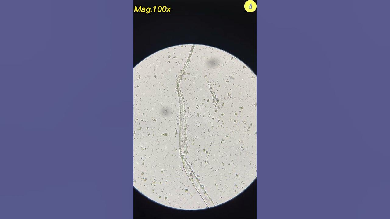 Condom Under Microscope | TULO - Microscope #shorts #underthemicroscope #condom